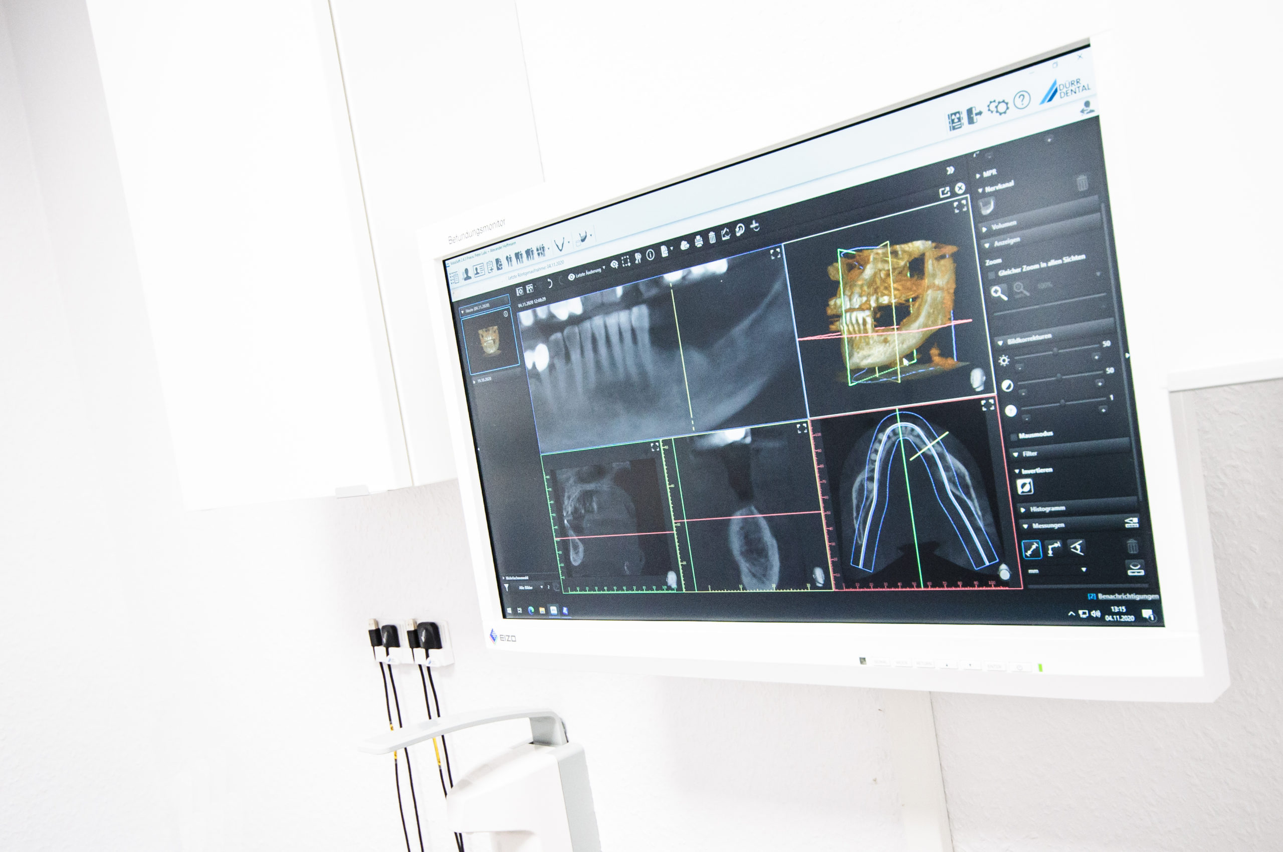 Röntgendiagnostik in 3D